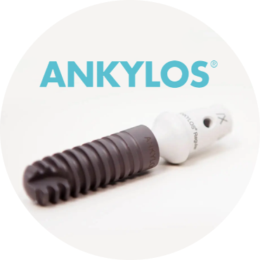 Импланты Ankylos